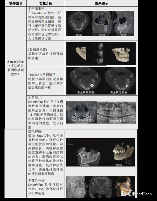 朗视最新CT技术，医疗影像领域的革新先锋